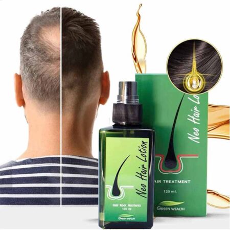 Neo Hair Lotion For Hair Growth In Pakistan